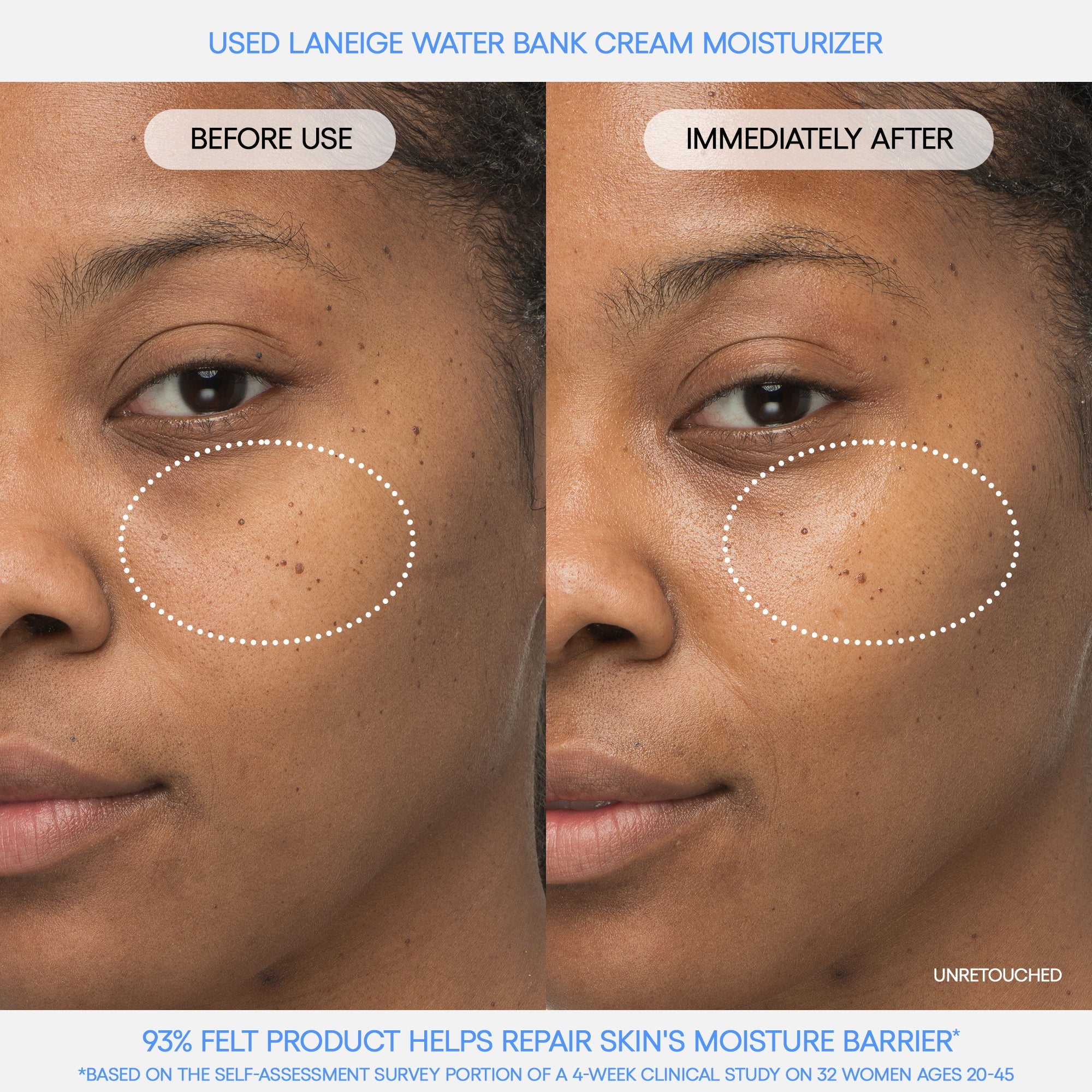 Water Bank Blue Hyaluronic Set