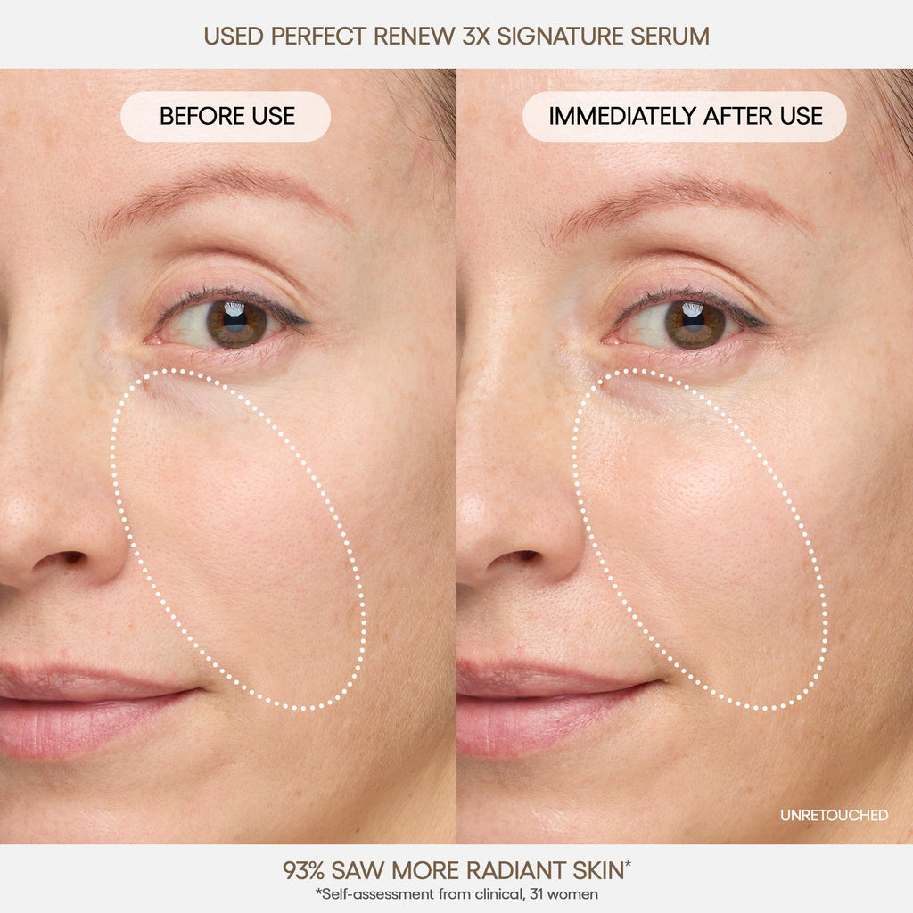 Perfect Renew 3X Signature Serum